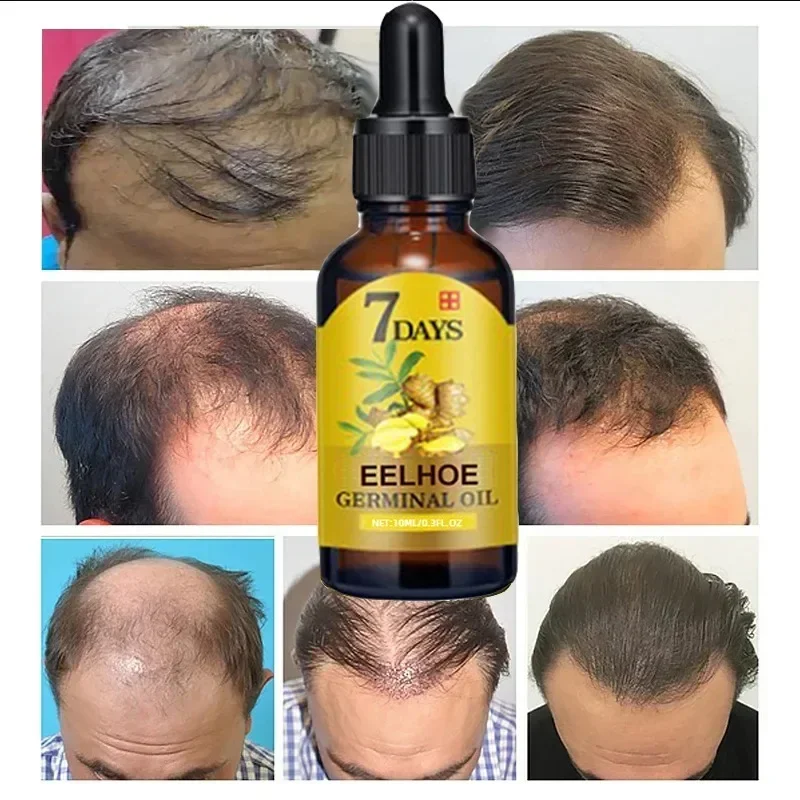 7 Day Fast Hair Growth Oil Gin - Epidermal Growth Factor ulasan dan harga
