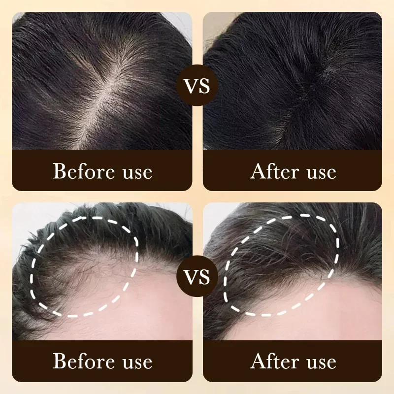 Biotin Fast Hair Growth Oil Pr - Epidermal Growth Factor ulasan dan harga