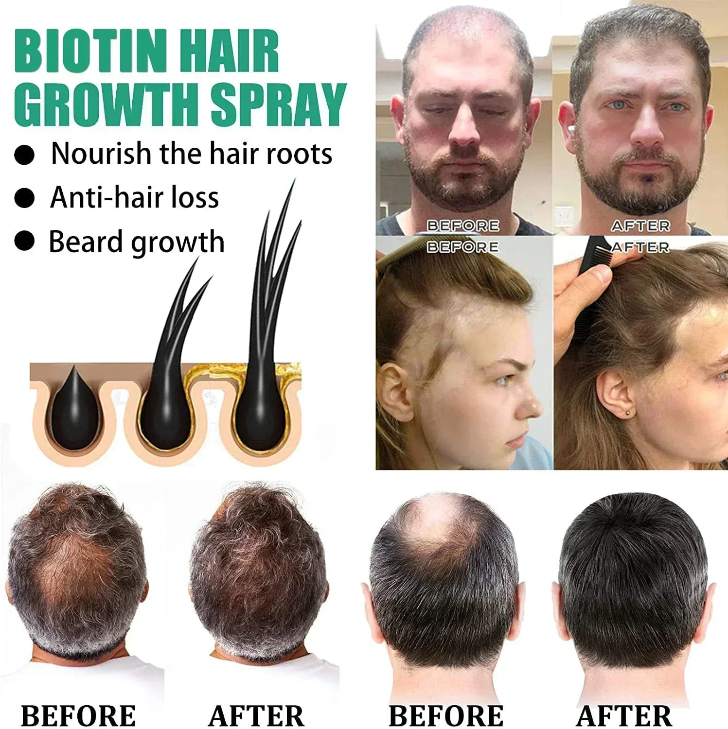 3RD Biotin Hair Spray For Man  - Epidermal Growth Factor ulasan dan harga